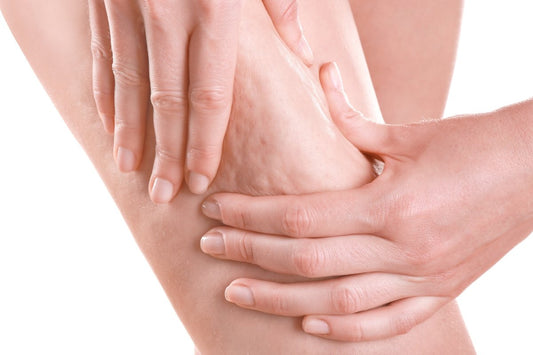 Cellulite: stop a carbo e zuccheri ora - Centiure - Take a Blue.